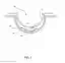 Fig. 02 - Variable optic ophthalmic device including liquid crystal elements