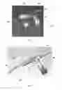 Fig. 05 - Contact interface input device