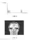 Fig. 08 - Techniques for generating a representative image and radiographic interpretation information for a case