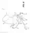 Fig. 07 - Systems and methods for determining and visualizing perfusion of myocardial muscle