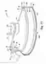 Fig. 16 - Motor with backing ring diecast in rotor can