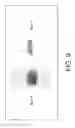 Fig. 13 - Platelet Storage and Reduced Bacterial Proliferation in Platelet Products Using a Sialidase Inhibitor
