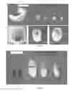 Fig. 04 - Method and compositions for the genetic control of insect pests in cotton plants by chitin synthase gene silencing
