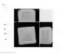 Fig. 02 - TRANSPARENT AND TRANSLUSCENT LIQUID FILLED CANDY; PROCESS OF MAKING THEREOF; SUGAR-FREE LIQUID EDIBLE COMPOSITION; AND USE THEREOF