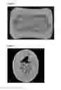 Fig. 04 - CENTER-FILLED CONFECTIONS AND METHOD OF MAKING SAME
