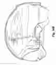 Fig. 33 - HELMET WITH RETRACTABLE VISOR AND BRIDGE