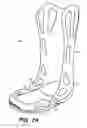 Fig. 06 - Adjustable walking apparatus