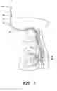 Fig. 02 - METHOD AND APPARATUS FOR PERFORMING TRANSESOPHAGEAL CARDIOVASCULAR PROCEDURES