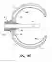 Fig. 15 - METHOD AND APPARATUS FOR PERFORMING TRANSESOPHAGEAL CARDIOVASCULAR PROCEDURES