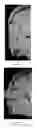 Fig. 06 - METHOD OF IMAGING BONE