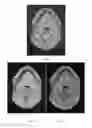 Fig. 07 - METHOD OF IMAGING BONE