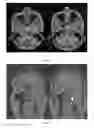 Fig. 08 - METHOD OF IMAGING BONE
