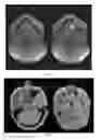 Fig. 09 - METHOD OF IMAGING BONE