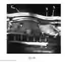 Fig. 03 - Automatic method of predictive determination of the position of the skin