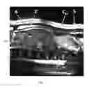 Fig. 09 - Automatic method of predictive determination of the position of the skin