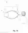 Fig. 02 - Device and method for non-invasive analysis of particles during medical ventilation