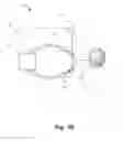 Fig. 06 - Device and method for non-invasive analysis of particles during medical ventilation