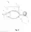 Fig. 07 - Device and method for non-invasive analysis of particles during medical ventilation