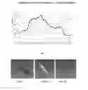 Fig. 07 - Systems and methods for detecting intracranial pressure and volume