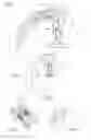 Fig. 02 - C-arm of medical imaging system