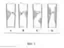 Fig. 02 - METHOD FOR ASSESSING STENOSIS SEVERITY THROUGH STENOSIS MAPPING