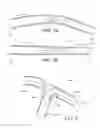 Fig. 05 - METHOD FOR ASSESSING STENOSIS SEVERITY THROUGH STENOSIS MAPPING