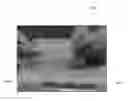 Fig. 01 - Medical imaging system with needle detection capability