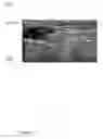Fig. 08 - Medical imaging system with needle detection capability