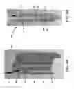 Fig. 07 - OPTICALLY AUGMENTED FINE NEEDLE ASPIRATION BIOPSY DEVICE AND METHOD OF USING THE SAME