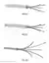 Fig. 05 - MULTIPLE-TISSUE FNA SAMPLING