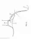 Fig. 07 - FISTULA TREATMENT DEVICES AND METHODS
