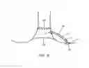 Fig. 09 - FISTULA TREATMENT DEVICES AND METHODS