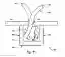 Fig. 15 - VESSEL CLOSURE DEVICES, SYSTEMS, AND METHODS