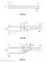 Fig. 09 - Adjustable suture knot
