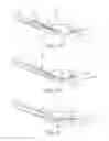 Fig. 07 - Suture assembly including a suture attached to a leader