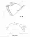 Fig. 22 - Method for surgical stapling