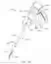 Fig. 35 - Surgical instrument with wireless communication between control unit and remote sensor