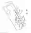 Fig. 71 - Surgical instrument with wireless communication between control unit and remote sensor