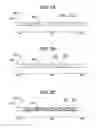 Fig. 03 - Methods and devices for soft palate tissue elevation procedures