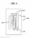 Fig. 06 - Methods and devices for soft palate tissue elevation procedures
