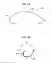 Fig. 07 - Methods and devices for soft palate tissue elevation procedures