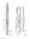 Fig. 77 - Stapling system comprising a lockout