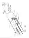 Fig. 85 - Stapling system comprising a lockout