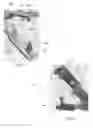 Fig. 08 - Hemostatic clip with needle passer