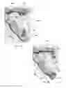 Fig. 10 - Hemostatic clip with needle passer