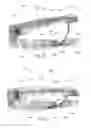 Fig. 13 - Hemostatic clip with needle passer