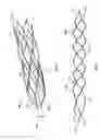 Fig. 02 - Systems and methods for restoring blood flow to a vessel