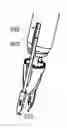 Fig. 01 - Trocar and wound closure device