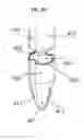 Fig. 07 - Trocar and wound closure device