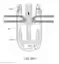 Fig. 32 - Trocar and wound closure device